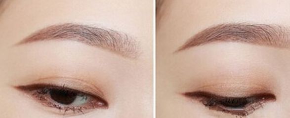 湖北哪家眼科醫(yī)院口碑最佳？這些醫(yī)院實(shí)力雄厚，贏得了廣泛贊譽(yù)。