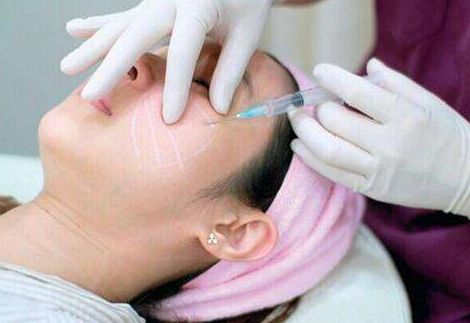 上海長海醫(yī)院宋建星醫(yī)生：雙眼皮手術新體驗，成功案例分享