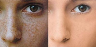 2023汕頭整形醫(yī)院吸脂排行榜及用戶(hù)評(píng)價(jià)揭曉！