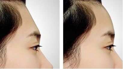 南通市最受歡迎的整形醫(yī)院推薦！在線評價說好，真實經(jīng)驗驚艷！