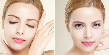 青島趙煜楠鼻修復案例分享-醫(yī)生秘笈曝光