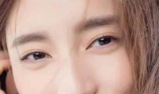 廈門盧藝樸：去眼袋術(shù)后驚艷臉龐，重拾年輕活力，醫(yī)生介紹鼎力推薦