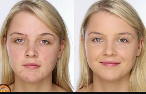 寧德醫(yī)美整形醫(yī)院哪家口碑比較好？雙眼皮價格查詢后的綜合評價如何？