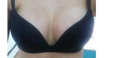 上海知名整形醫(yī)師盤點！這些隆鼻專家你不能錯過