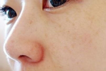 蘭州大學(xué)第二醫(yī)院私密整形部門案例揭示，充滿驚喜！