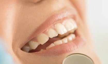 銀川哪家醫(yī)院有專業(yè)的熱瑪吉技術(shù)祛黑眼圈？2023年最新排名出爐，趕緊看看前十名單！