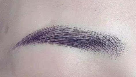 武漢市一醫(yī)院整形科值得信賴嗎？有人親自體驗(yàn)過熱瑪吉恢復(fù)過程嗎？