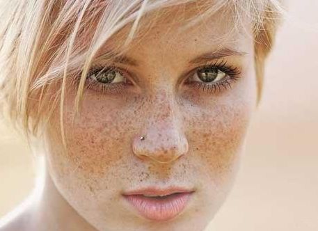 沈陽協(xié)和醫(yī)院受歡迎的雙眼皮手術2023案例分享