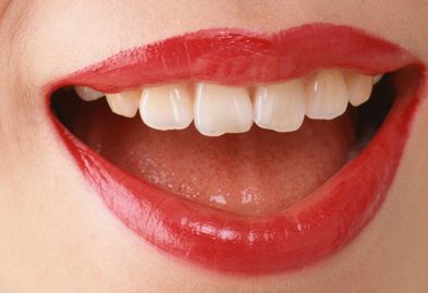 神奇！90天內(nèi)西安伍航利醫(yī)生雙眼皮見證，效果驚人