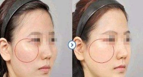 南京明星雙眼皮修復(fù)醫(yī)生排行榜2023，黃金龍、劉育鳳等著名專家入選！