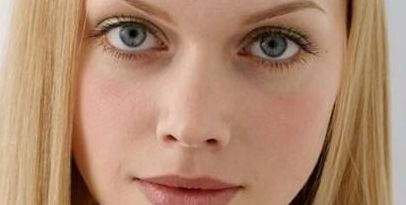 天津美萊整形美容醫(yī)院隆鼻技術(shù)及成功案例分享