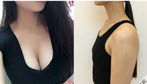 中國醫(yī)學科學院整形外科醫(yī)院李發(fā)成醫(yī)生的項目特長內容是什么？詳細資料及就診信息介紹