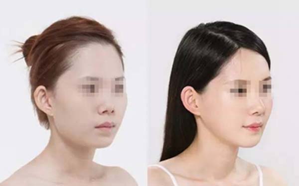 貴州六盤水吳氏嘉美整形醫(yī)院是口碑不錯嗎？如何一鍵獲取醫(yī)院口碑？