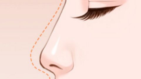 國內(nèi)整容醫(yī)院哪家值得信賴？面部吸脂推薦選這幾家！公立和私立醫(yī)美機(jī)構(gòu)實力強(qiáng)勁！