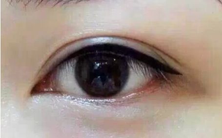 2023年四川明星雙眼皮專家全球發(fā)布丨郭祥文、郭波、肖海濤top5醫(yī)師介紹