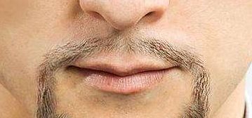 烏魯木齊市有口碑佳的整形醫(yī)院推薦！專業(yè)實力不容錯過！