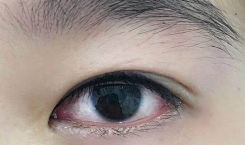 上海整形界最受歡迎的吸脂專家推薦，李耐國、曹衛(wèi)剛、李發(fā)成等醫(yī)生備受贊譽！附真實案例供參考