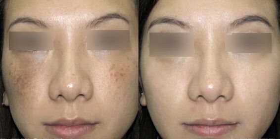 揭秘南京鼻王身份！專家盛贊前五強(qiáng)醫(yī)生，引人入勝！