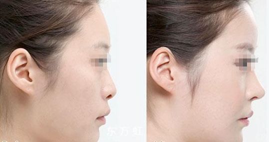 蘇州無線頻率融脂專科醫(yī)生排名前十這幾位醫(yī)術(shù)聲譽超卓的醫(yī)生是您的不二之選