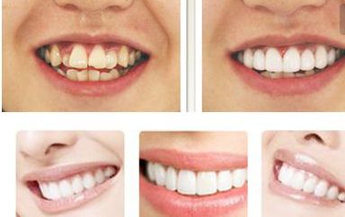 哪位醫(yī)生在北京最擅長鼻修復？不得不提的鼻整形專家！