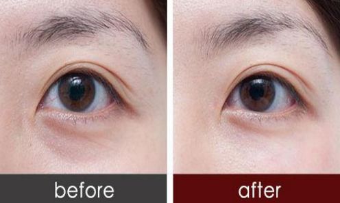 廣州荔灣人民醫(yī)院與中家醫(yī)整容醫(yī)院：醫(yī)療實力PK，看誰更勝一籌