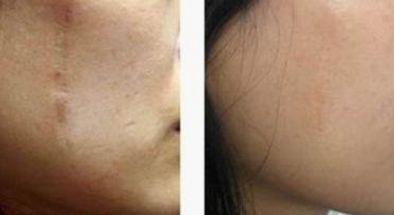 國內(nèi)有哪些值得推薦的磨骨權(quán)威專家？優(yōu)秀磨骨師張笑天、李志海等值得關(guān)注