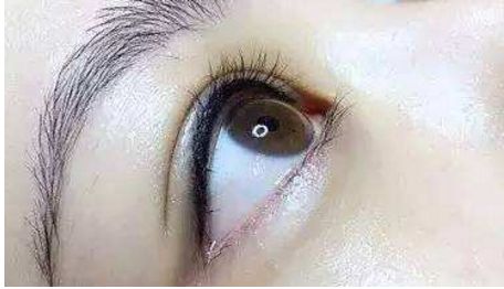 長沙哪位醫(yī)生在雙眼皮修復技術(shù)上口碑好找排名靠前的？