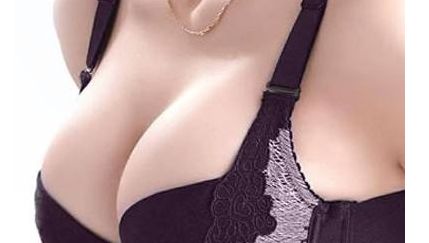 北京王光輝雙眼皮術后半年感受大揭秘！