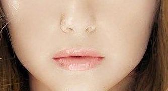 王維九院的雙眼皮修復(fù)技術(shù)值得信賴嗎？專家實(shí)力與成功案例給出參考