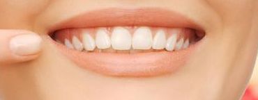 溫州和平整形醫(yī)院2023年隆胸手術(shù)案例分享及效果披露