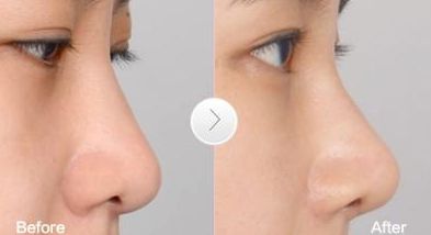 高效祛疤地，推薦的整形醫(yī)院在廣州！更有名口碑榜單盤點(diǎn)