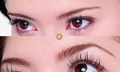 上海眼袋手術(shù)有哪些醫(yī)院推薦？這些醫(yī)療機構(gòu)醫(yī)術(shù)高超！