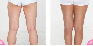 鄭州修復(fù)雙眼皮的專家推薦！這些醫(yī)院排名靠前、信譽(yù)有保障