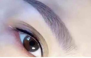 廣州治療內(nèi)眼角凹陷，選擇這幾家醫(yī)院最靠譜