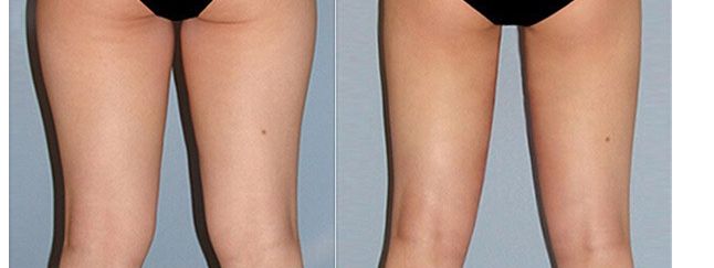 溧陽(yáng)市眼科專(zhuān)家就診推薦，醫(yī)生名單及治療費(fèi)用一覽