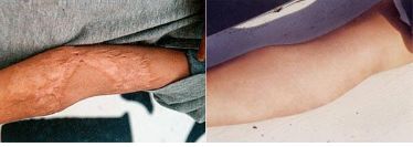 遼寧省近視治療醫(yī)院五佳榜單，這幾家醫(yī)院翹楚地位！