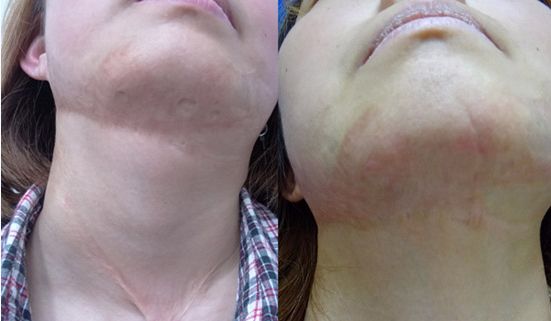 上海九院下頜角整形領(lǐng)域的知名醫(yī)師推薦！名醫(yī)師百人精選！