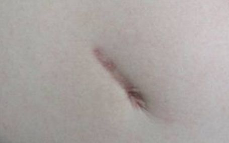 武漢頂尖眼袋整形醫(yī)生綜合評(píng)比當(dāng)?shù)刂t(yī)師資料公開(kāi)揭曉