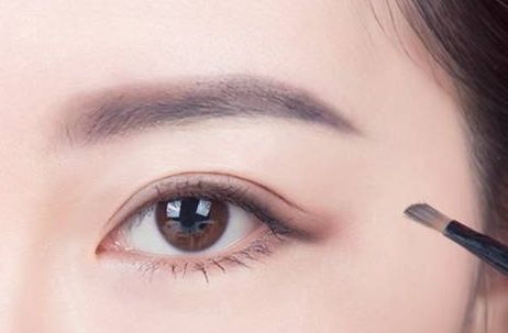 蜜月時光，揭秘黃筱琳醫(yī)生傾情打造的上海九院雙眼皮！2023年最新案例給你參考！