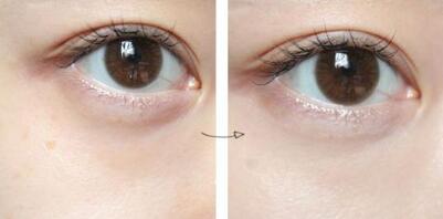 滄州隆鼻有哪些醫(yī)院可以做？如何選擇適合自己的醫(yī)院