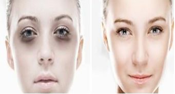 上海第九人民醫(yī)院正頜正畸：專(zhuān)家團(tuán)隊(duì)幫您獲得完美笑容