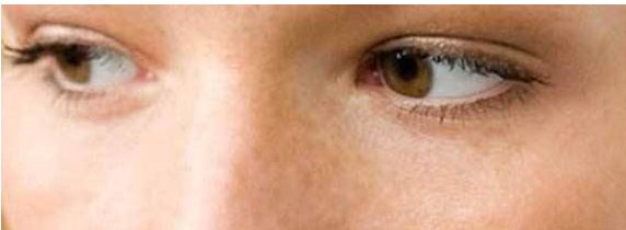 想改善雙眼皮？來鄭州三院看看王江允！了解費用可參考2023價格表。