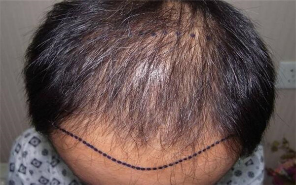 無錫細紋去除有經(jīng)驗的整形醫(yī)院排名榜單2023出爐，前十強測評發(fā)布！