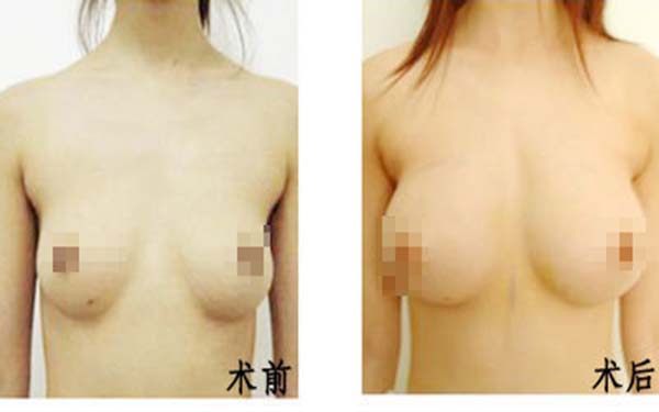 遂寧伊莎貝拉醫(yī)學美容門診部醫(yī)生是否值得信賴？他們的專業(yè)素質如何？