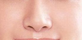 袁斯明醫(yī)生手術(shù)預(yù)約時效如何？祛疤效果有多好？解讀金陵醫(yī)院專家信息！