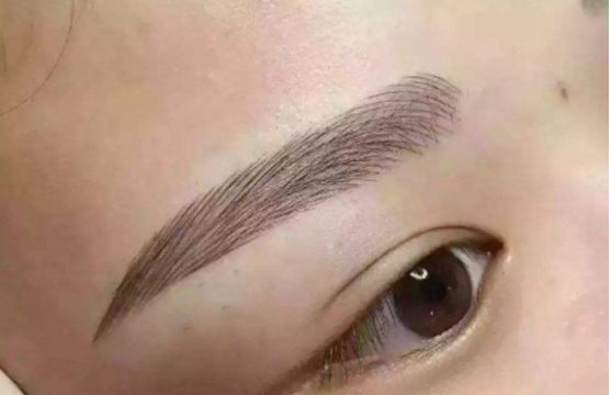 杭州時(shí)光項(xiàng)昌峰醫(yī)生引領(lǐng)新潮，時(shí)尚體驗(yàn)案例分享