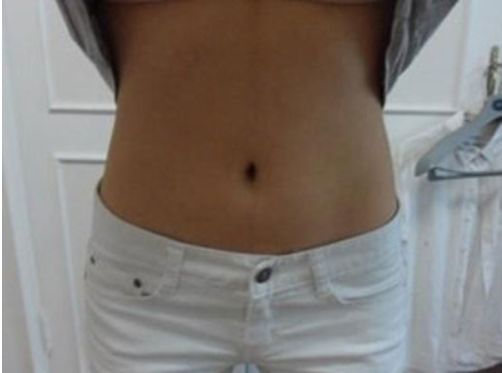 國內知名雙眼皮大師推薦名單，附蘇薇潔、魏志香、王世勇等醫(yī)師！