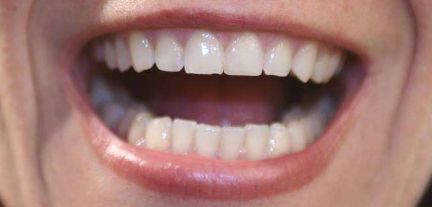 申霄與銀山：雙眼皮醫(yī)生大PK！誰更出彩？