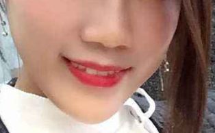 想要做隆鼻手術(shù)如何避免不好的經(jīng)歷？成功隆鼻必備指南！