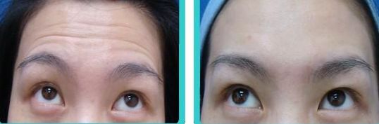 廣州市最受歡迎的私立整形醫(yī)院排行榜前十強(qiáng)